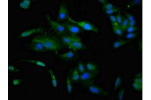 Immunofluorescence staining of Hela cells with ABIN7147596 at 1:100, counter-stained with DAPI. (CCKAR antibody  (AA 235-313))