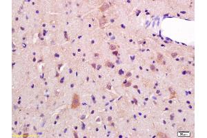 Formalin-fixed and paraffin embedded rat brain labeled with Rabbit Anti JNK2 Polyclonal Antibody, Unconjugated (ABIN681403) at 1:200 followed by conjugation to the secondary antibody and DAB staining (JNK1/2 antibody  (AA 311-424))