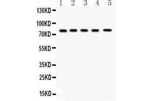Western blot analysis of FSH Receptor expression in rat testis extract ( Lane 1), rat ovary extract ( Lane 2), mouse testis extract ( Lane 3) mouse ovary extract ( Lane 4) and HELA whole cell lysates ( Lane 5). (FSHR antibody  (AA 18-187))