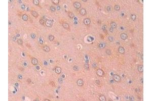 Detection of CA12 in Rat Cerebrum Tissue using Polyclonal Antibody to Carbonic Anhydrase XII (CA12) (CA12 antibody  (AA 154-307))