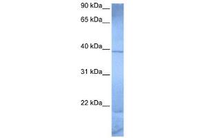 WB Suggested Anti-ZNF121 Antibody Titration:  0. (ZNF121 antibody  (Middle Region))