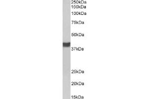 ABIN5539507 (0. (Cardiac Troponin T2 antibody  (C-Term))