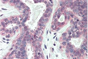 ABIN263217 (5µg/ml) staining of paraffin embedded Human Breast. (XBP1 antibody  (Internal Region))