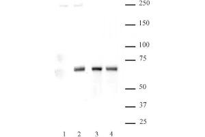 NFκB p65 phospho Ser536 pAb tested by Western blot. (NF-kB p65 antibody  (pSer536))