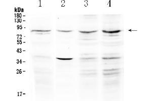 Western blot analysis of ECE1 using anti- ECE1 antibody .