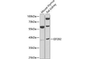 Western blot analysis of extracts of various cell lines, using EIF2B2 antibody (ABIN6132131, ABIN6140037, ABIN6140038 and ABIN6222805) at 1:1000 dilution. (EIF2B2 antibody  (AA 1-351))
