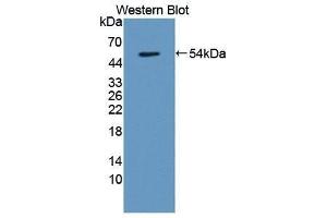 Western Blotting (WB) image for anti-Transmembrane Protein 27 (TMEM27) (AA 15-141) antibody (ABIN1871658)