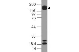 Image no. 1 for anti-AT Rich Interactive Domain 5B (MRF1-Like) (ARID5B) (AA 430-621) antibody (ABIN5027366) (ARID5B antibody  (AA 430-621))