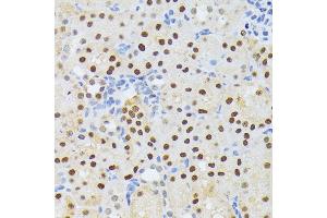 Immunohistochemistry of paraffin-embedded mouse kidney using EL antibody (ABIN6132052, ABIN6140108, ABIN6140109 and ABIN6222942) at dilution of 1:200 (40x lens). (ELAC2 antibody  (AA 1-270))