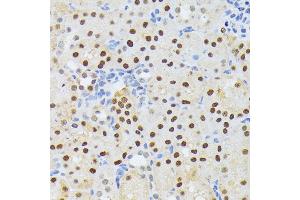 Immunohistochemistry of paraffin-embedded mouse kidney using EL antibody (ABIN6132052, ABIN6140108, ABIN6140109 and ABIN6222942) at dilution of 1:200 (40x lens). (ELAC2 antibody  (AA 1-270))