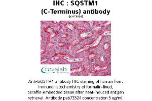 Image no. 1 for anti-Sequestosome 1 (SQSTM1) (C-Term) antibody (ABIN1739629) (SQSTM1 antibody  (C-Term))