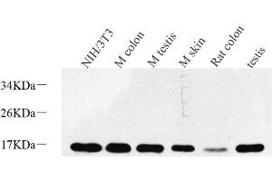 Western Blot analysis of various samples using Survivin Polyclonal Antibody at dilution of 1:600. (Survivin antibody)