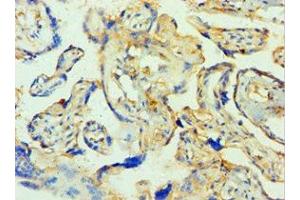 Immunohistochemistry of paraffin-embedded human placenta tissue using ABIN7171585 at dilution of 1:100 (TTBK2 antibody  (AA 1185-1244))