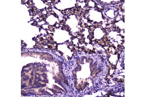 IHC analysis of FABP5 using anti-FABP5 antibody . (FABP5 antibody)