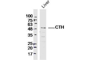 Lane 1: Mouse liver lysates probed with CTH Polyclonal Antibody, Unconjugated  at 1:300 overnight at 4˚C. (CTH antibody)
