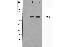 Western blot analysis on A549 and HuvEc cell lysate using TRI18 Antibody.