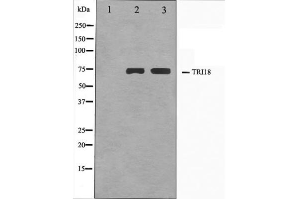 MID1 Antikörper  (N-Term)