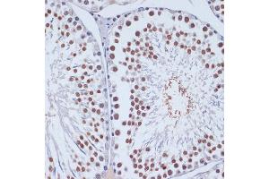 Immunohistochemistry of paraffin-embedded rat testis using DNMT3L antibody (ABIN3023228, ABIN3023229, ABIN3023230 and ABIN6219498) at dilution of 1:100 (40x lens). (DNMT3L antibody  (AA 1-386))