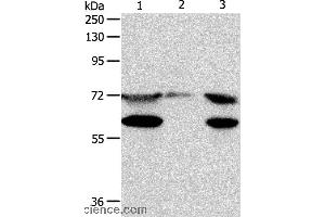 Western blot analysis of Hela cell, mouse testis tissue and Jurkat cell, using SPDL1 Polyclonal Antibody at dilution of 1:400 (CCDC99 antibody)