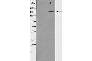 Western blot analysis of extracts of Jurkat, using MED1 antibody.