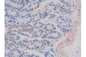 IHC-P analysis of Mouse Intestine Tissue, with DAB staining. (IL11RA antibody  (AA 194-329))