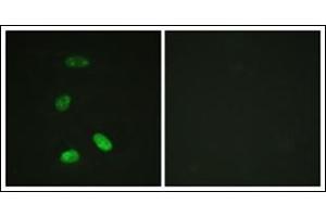 Immunofluorescence analysis of HeLa cells, using MYB antibody. (MYB antibody  (N-Term))