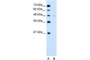 WB Suggested Anti-SLC43A3 Antibody Titration:  2. (SLC43A3 antibody  (N-Term))