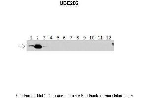 Lanes:   1: 40ng HIS-UBE2D1 protein 2: 40ng HIS-UBE2D2 protein 3: 40ng HIS-UBE2D3 protein 4: 40ng HIS-UBE2D4 protein 5: 40ng HIS-UBE2E1 protein 6: 40ng HIS-UBE2E2 protein 7: 40ng HIS-UBE2E3 protein 8: 40ng HIS-UBE2K protein 9: 40ng HIS-UBE2L3 protein 10: 40ng HIS-UBE2N protein 11: 40ng HIS-UBE2V1 protein 12: 40ng HIS-UBE2V2 protein. (UBE2D2 antibody  (N-Term))