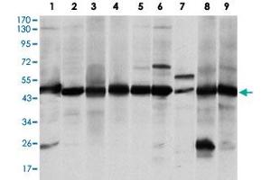 Western blot analysis of ASS1 monoclonal antibody, clone 2B10  against A-431 (1), RAJI (2), L1210 (3), MOLT4 (4), Jurkat (5), A-549 (6), NIH/3T3 (7), PC-12 (8) and COS-7 (9) cell lysate.