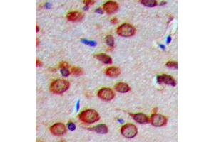 Immunohistochemical analysis of Carbonic Anhydrase 8 staining in human brain formalin fixed paraffin embedded tissue section. (CA8 antibody  (Center))