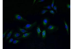 Immunofluorescent analysis of Hela cells using ABIN7173305 at dilution of 1:100 and Alexa Fluor 488-congugated AffiniPure Goat Anti-Rabbit IgG(H+L) (PVRIG antibody  (AA 193-326))