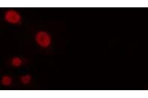 ABIN6274252 staining Hela cells by IF/ICC. (BUD31 antibody  (N-Term))