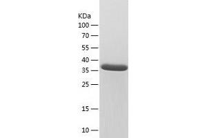 Western Blotting (WB) image for N-Acetylglucosamine Kinase (NAGK) (AA 1-344) protein (His tag) (ABIN7289306) (NAGK Protein (AA 1-344) (His tag))