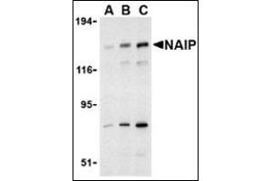 Western blot analysis of NAIP in PC-3 cell lysate with this product at (A) 0. (NAIP antibody  (C-Term))