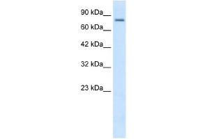 KCNN3 antibody used at 2 ug/ml to detect target protein. (KCNN3 antibody  (C-Term))