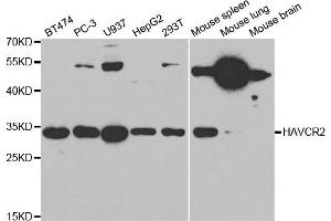 Western Blotting (WB) image for anti-Hepatitis A Virus Cellular Receptor 2 (TIM 3) antibody (ABIN1872939) (TIM3 antibody)
