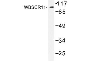 Image no. 1 for anti-General Transcription Factor II I Repeat Domain-Containing 1 (GTF2IRD1) antibody (ABIN272259) (GTF2IRD1 antibody)