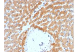 Immunohistochemistry (IHC) image for anti-ADP-Ribosylation Factor 1 (ARF1) antibody (ABIN6939846)