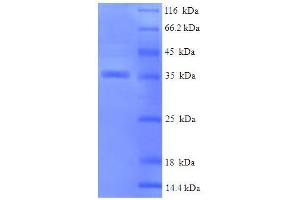 SDS-PAGE (SDS) image for Crystallin, alpha B (CRYAB) (AA 1-175), (full length) protein (His-SUMO Tag) (ABIN4974373)