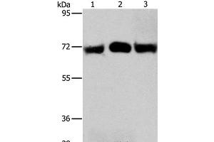 Western Blot analysis of Hela and A549 cell, Human liver cancer tissue using RPN1 Polyclonal Antibody at dilution of 1:350 (RPN1 antibody)