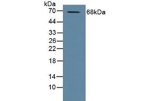 Figure. (ADAM10 antibody  (AA 420-641))