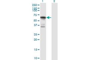 Western Blot analysis of ATE1 expression in transfected 293T cell line by ATE1 monoclonal antibody (M01), clone 2B6. (ATE1 antibody  (AA 1-87))