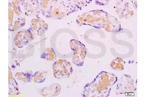 Formalin-fixed and paraffin embedded human placenta labeled with Anti-FLIP Polyclonal Antibody, Unconjugated (ABIN737946) at 1:200 followed by conjugation to the secondary antibody and DAB staining. (FLIP antibody  (AA 401-480))