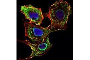 Immunofluorescence analysis of NIH/3T3 cells using SMAD3 mouse mAb (green).