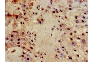 Immunohistochemistry of paraffin-embedded human placenta tissue using ABIN7156486 at dilution of 1:100 (Integrin beta 4 antibody  (AA 1401-1533))