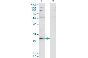 Western Blot analysis of LBX2 expression in transfected 293T cell line by LBX2 monoclonal antibody (M02), clone 3A5.