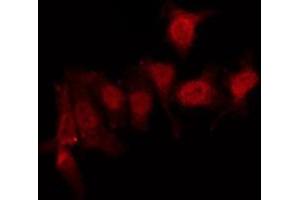 ABIN6275959 staining Hela by IF/ICC. (GPR152 antibody  (N-Term))