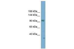 RC3H2 antibody used at 1 ug/ml to detect target protein. (RC3H2 antibody  (Middle Region))