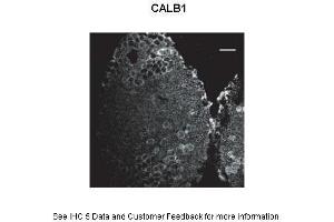 Primary Antibody Dilution: 1:500Secondary Antibody: Donkey anti-rabbit Alexa 488 Secondary Antibody Dilution: 1:000  Gene Name: CALB1 Submitted by: Anonymous (CALB1 antibody  (C-Term))