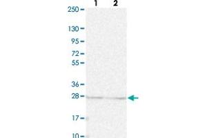 Western blot analysis of Lane 1: Human cell line RT-4 Lane 2: Human cell line U-251MG sp with KPNA1 polyclonal antibody  at 1:250-1:500 dilution.